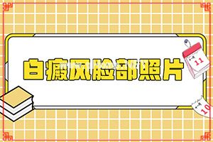 （白殿风）身体出现白斑是怎么回事[治疗怎么做]