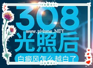 为什么白癫疯治疗一年咋还没见好-什么人容易得白颠疯