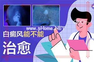 卤米松乳膏治疗白斑效果盒子黄色加白