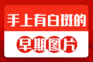 白点癫风初期有多大,患上皮肤会有哪些特征(怎么分辨)