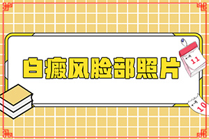 小孩身上有白白的一块怎么办，这是局部色素脱失引起的