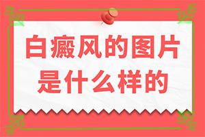  硼砂可以治白癫风吗