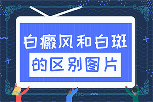 一家三代每逢夏天脸上就起白班[是怎么引起的]白癫的原因是什么