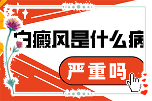 白癫疯病的早期能治的好吗,治疗白点病的专业医院