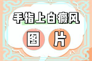 三岁女宝宝脸上好多白色的一块块斑点