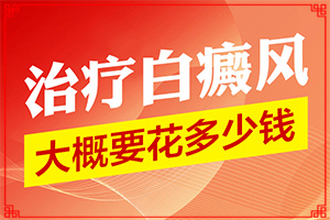 女友家里有两个白点癫风?怎么治疗白癜风