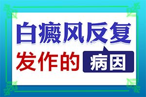 白斑是什么原因引起的(不如试试这种方法)