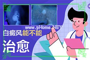 感觉宝宝脸上有白斑-小腹长白斑是什么原因