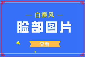  白点癫风遗传下一代吗能治好吗多少钱