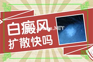 308nm准分子激光治疗白斑-黑色素为什么脱失