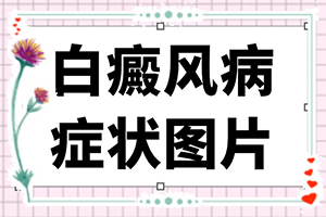 手上长了很多小点点-白癫疯初期症状-哪些症状可以让我们认识