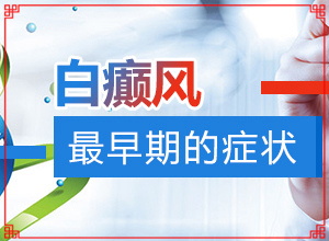 「在线答疑」白殿的图片「重要发布」白班的图片