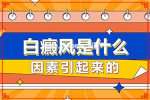 白点癫风用什么药膏-小孩脸上有白瘀风怎么治