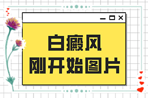 白癞风治疗方法[应该注意哪些]四肢上的白殿风能治好吗