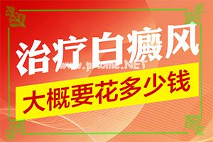 （白天风）白癫风早期怎么治疗-方法要记牢