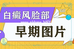 小孩胸口有白斑怎么办-17个月的宝宝脸上有白斑