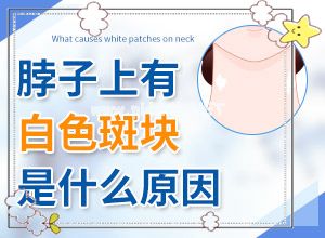 (科学应对)全国白斑医院排名[黑色素移植怎么样]