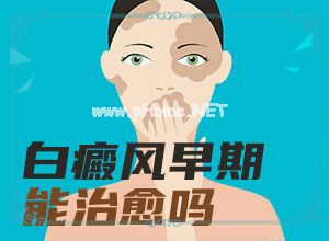 [详细了解]白风病用什么药-哪些会诱发呢