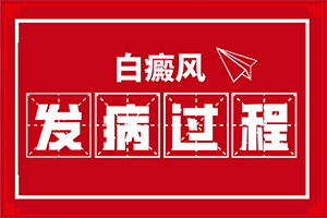 「一点即透」治疗白殿疯方法？白颠疯能治吗