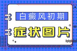 (关注)治癜风秘方[有什么科学的方法]