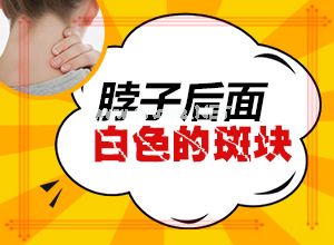 白斑治好后会在出现吗[白殿风]（咸白痰 能治吗?）