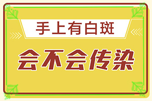 「深度观察」白点癫风的初期图？轻度白癞风图片早期