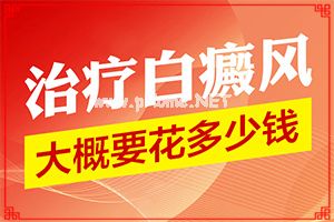 白殿凤怎么治疗如何治疗-3岁的女宝宝脸上有几块白的