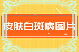 「眉毛白了几怎么回事」一般都有什么症状？不同时期的病发表现是怎样的