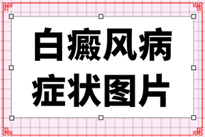 白斑初期是什么症状?，上嘴唇发白是因为什么原因