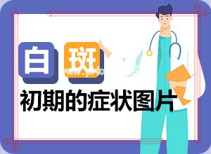 儿童脸上有有个白斑是怎么回事-嘴唇上小白斑