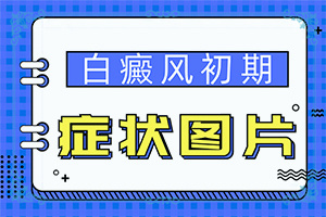 小孩脸上有白斑块[征兆有哪些]白癜风的初期症状及图片