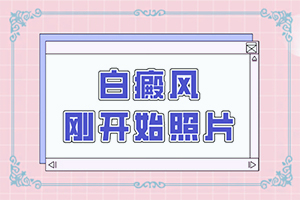 头有白斑是什么回事,哪些因素会导致白癜风(科学了解诱白原因)