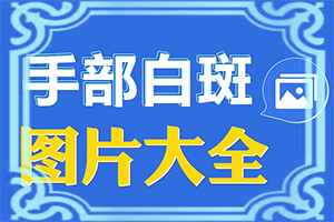 「栏目新递」白殿疯病初期「白白知晓」白癞风和白斑区别