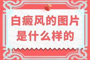  白殿风的最佳治疗方案