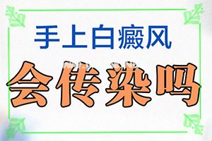 怎么确定是不是白癞风[自我诊断]早期白癞风是小白点吗