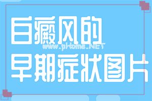 方法报告-白点癫风有什么偏方吗-治疗方法大公开