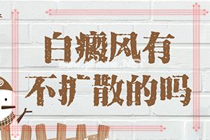 白巅峰的人可以治疗-白点癫风如何根治