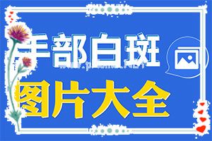 （新进展）脸上长白斑买什么药膏擦-白癞风好的治疗法