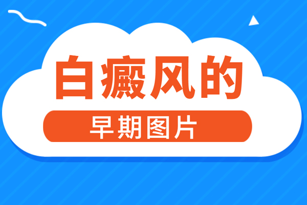 白癜风皮肤也会出现瘙痒吗,白斑处瘙痒到底是什么情况