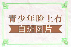 白斑正规医院(身上突然有一些白斑)