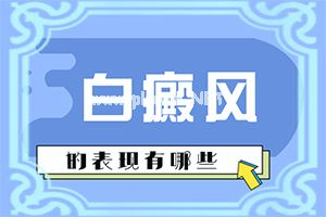 得了白癫疯就没办法治吗(这样治疗花费少)