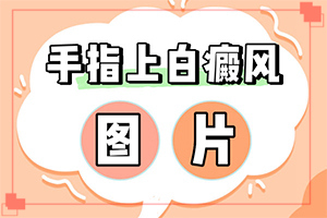 白斑与周围皮肤对比明显边界模糊“4个多月的宝宝脸上有白斑正常吗”光滑的白斑是吗