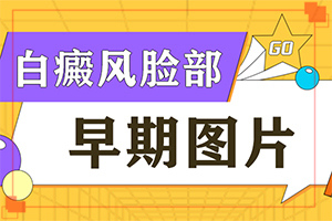 白斑早期症状大，过敏身上白块是什么原因