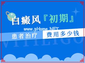 白癫治疗费用是多少[多久做一次比较好]治疗手上白斑有效的方法