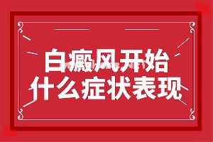 皮肤偶尔起白斑怎么回事-有哪些方法能治疗白癜风呢